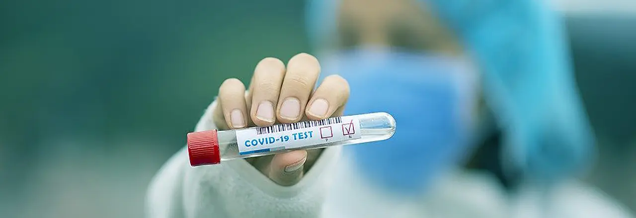 Test COVID-19