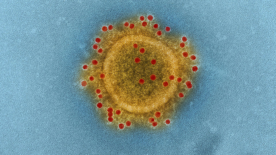 Partícuila de Coronavirus. National Institute of Allergy and Infectious Diseases (NIAID)