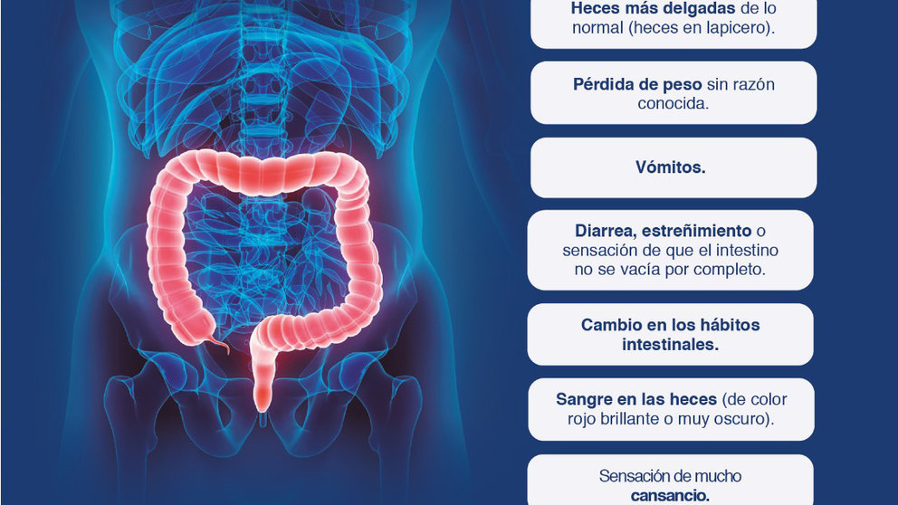 Síntomas del cámcer de colon
