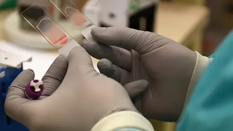 A 48th Medical Support Squadron laboratory technician looks at slides at Royal Air Force Lakenheath, England, Aug.14, 2019. Laboratory technicians at the 48th Fighter Wing have an integral role in providing Airmen and their family members with a proper diagnosis and treatment to support the readiness mission. (U.S. Air Force photo by Airman 1st Class Madeline Herzog)


