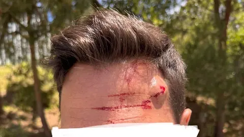 Heridas sufridas por el agente.