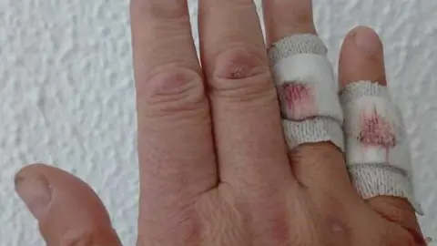 Un guardia civil lesionado durante la borrasca / AUGC