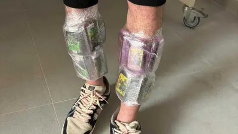 Hach&iacute;s adosado a las piernas del detenido.